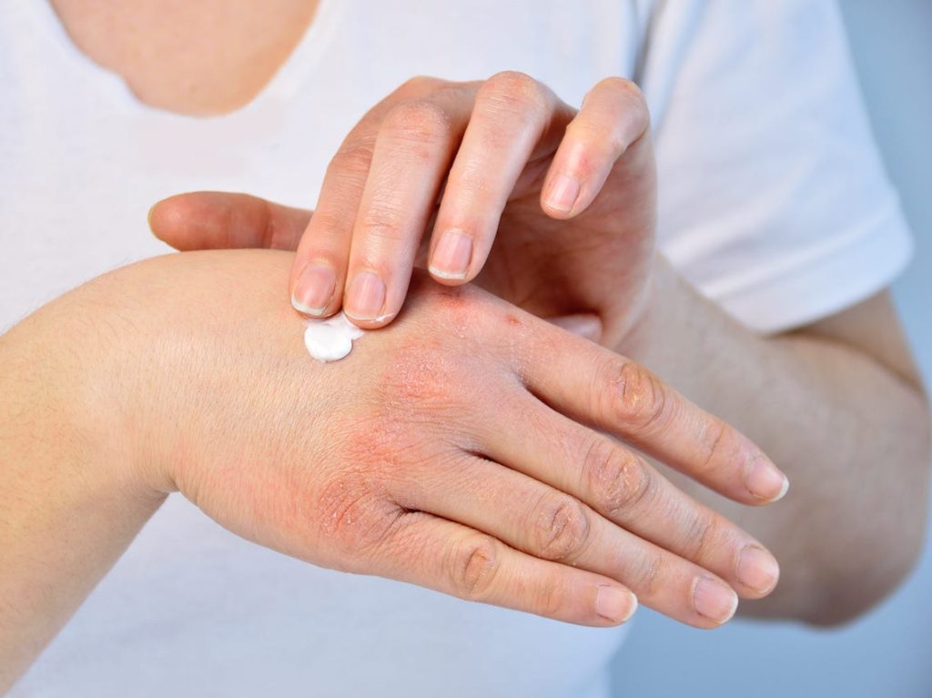 Dermatologët: “Dimri është stina më e rrezikshme për lëkurën – hidratimi është domosdoshmëri”