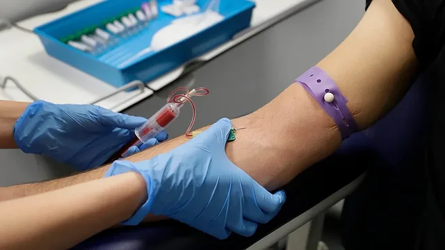 HIV-i i padiagnostikuar një krizë e heshtur për Europën