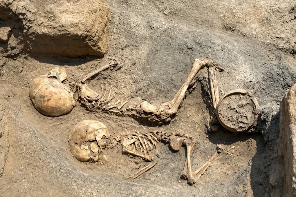 Zbulohet ndërhyrja më e lashtë neurokirurgjikale në Azinë Qendrore, kafka e një fëmije me shenja trepanimi