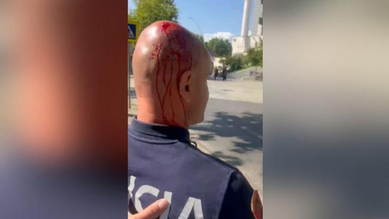 10:02 Polici i mbuluar me gjak nga gurët e protestuesve, Balla: Kjo nuk është më protestë paqësore, është terrorizëm