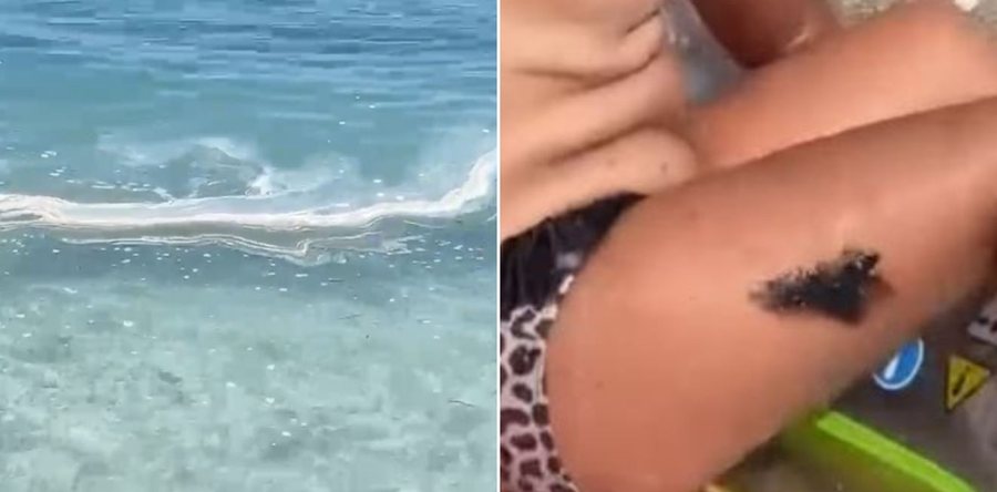 Turistët në Borsh dalin nga deti me naftë në trup, pas aromës të pakëndshme, vijojnë DENONCIMET për ujin e mbushur me njolla të zeza