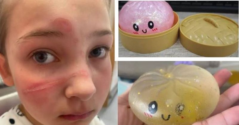 Alarm për lodrat “squishy”, SHBA i tërheq nga tregu: Janë të rrezikshme për jetën e fëmijëve