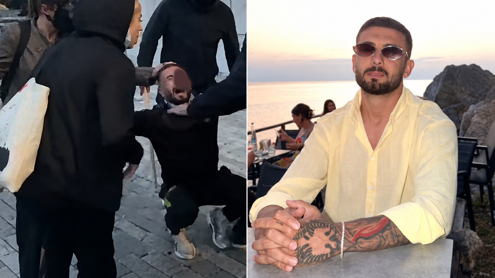 U godit me plumb gome në sy gjatë protestës, Erjon Vishkulli do të niset sot për kurim jashtë Shqipërisë
