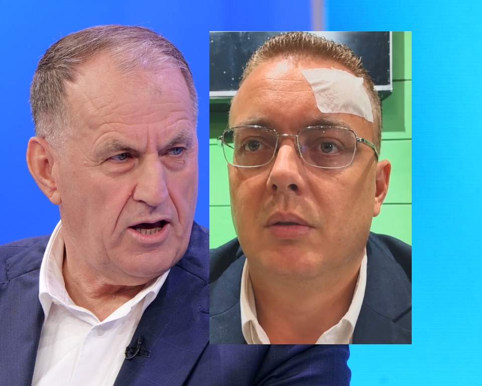 Aktivisti i fashuar përballet me zv.ministrin e brendshëm: Më dhunoi policia me shufër hekuri! Qefalia: Të shkuara!